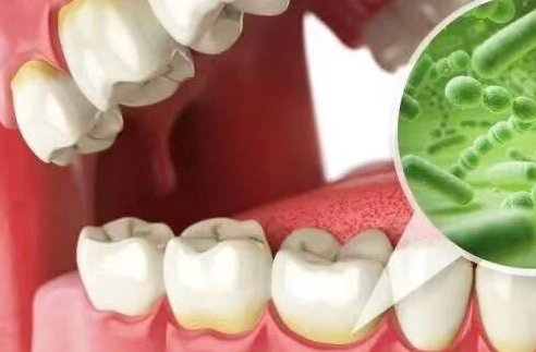 【牙周炎】正在殺死95%中國人嘅“牙齒”！